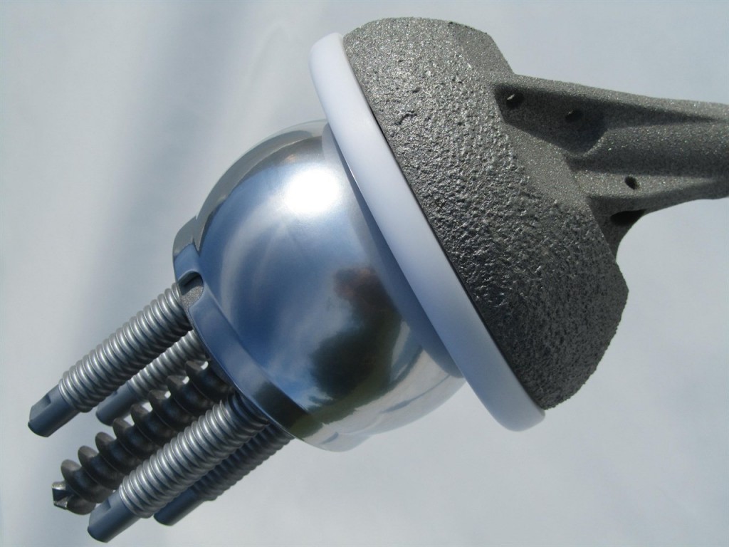 Shoulder Implant Model