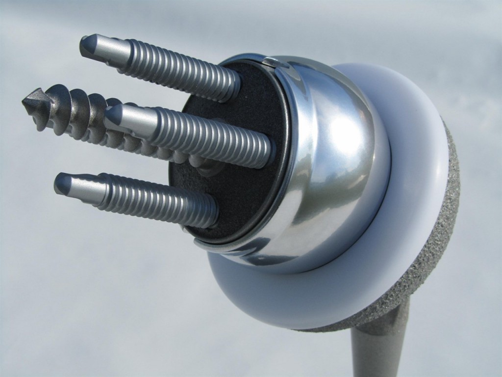 Shoulder Implant Model