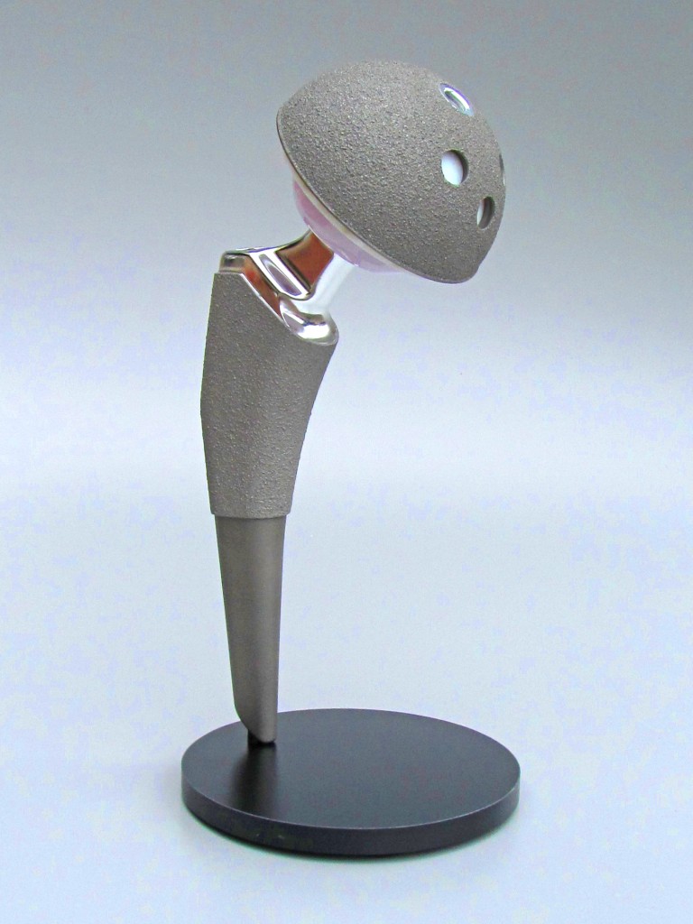 hip implant model
