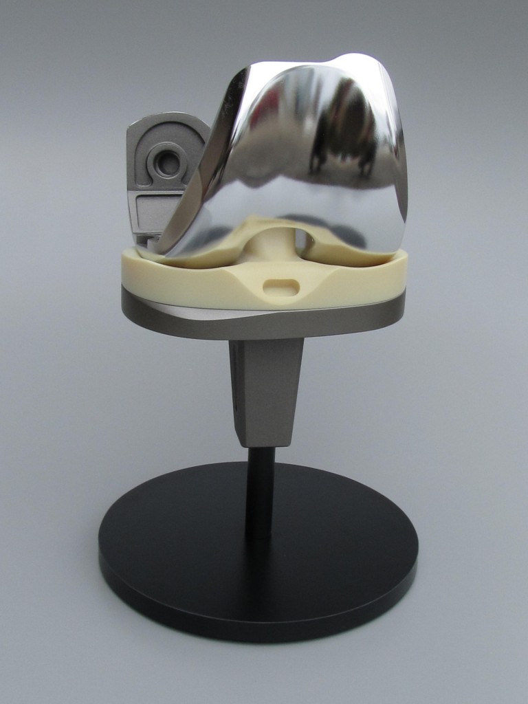 Knee Implant Model